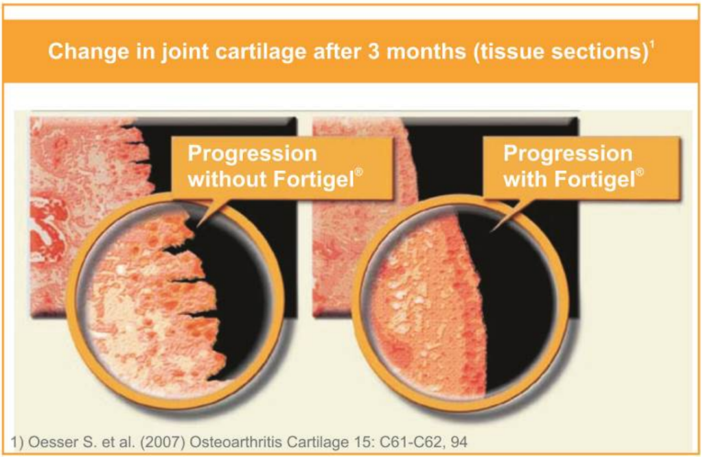 Change In Joint Cartilage After 3 Months