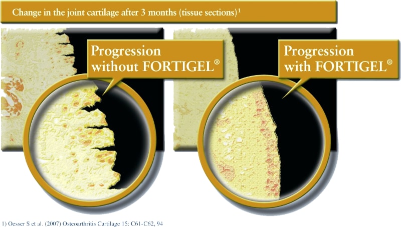 hiệu quả của collagen peptide type 2 Fortigel®
