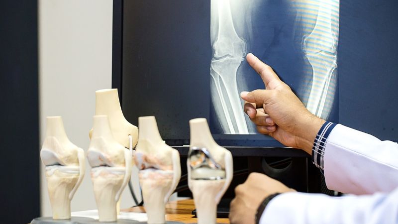 chẩn đoán khô khớp gối
