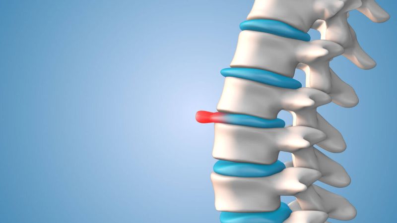 thoát vị đĩa đệm là một trong những bệnh xương khớp dân văn phòng thường gặp