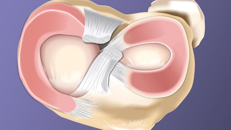 vai trò của sụn chêm trong