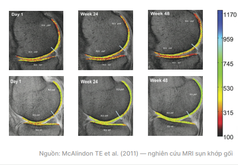 Chuỗi MRI ngày 1, tuần 24 và tuần 48 với thang màu và nguồn nghiên cứu McAlindon